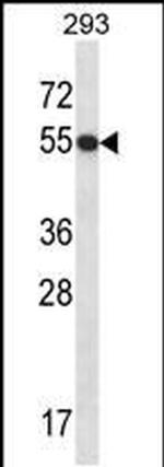 GTF2E1 Antibody in Western Blot (WB)