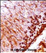 NEK5 Antibody in Immunohistochemistry (Paraffin) (IHC (P))