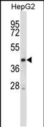 STK25 Antibody in Western Blot (WB)