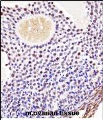 WEE2 Antibody in Immunohistochemistry (Paraffin) (IHC (P))
