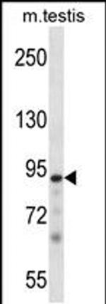 PKN3 Antibody in Western Blot (WB)
