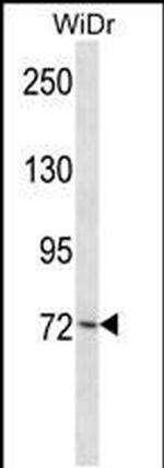PLK3 Antibody in Western Blot (WB)