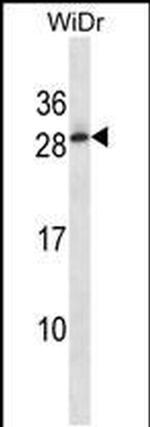 C11orf20 Antibody in Western Blot (WB)