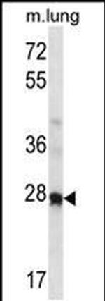 HOXA4 Antibody in Western Blot (WB)