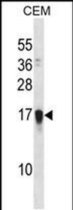 FAM163A Antibody in Western Blot (WB)