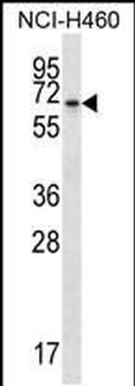 BEND4 Antibody in Western Blot (WB)