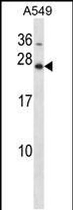 HOXB7 Antibody in Western Blot (WB)