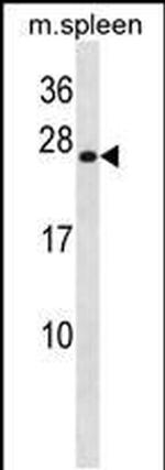 HOXB7 Antibody in Western Blot (WB)