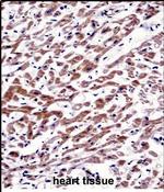 MOV10 Antibody in Immunohistochemistry (Paraffin) (IHC (P))