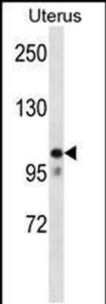 MOV10 Antibody in Western Blot (WB)