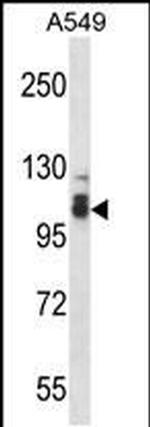 SMEK2 Antibody in Western Blot (WB)