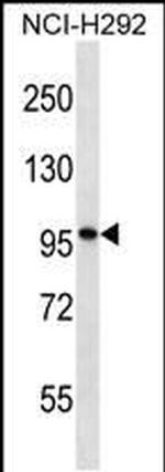 PTCHD2 Antibody in Western Blot (WB)