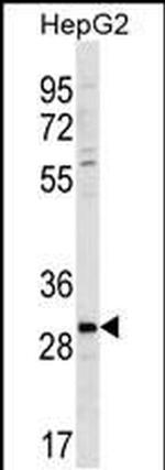 ZDHC3 Antibody in Western Blot (WB)