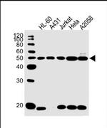 KRT28 Antibody in Western Blot (WB)