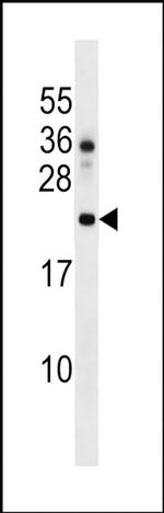DNAJC24 Antibody in Western Blot (WB)