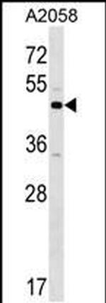 XKR3 Antibody in Western Blot (WB)