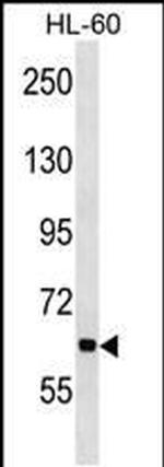 ANKHD1 Antibody in Western Blot (WB)