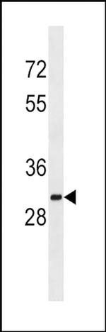 SULT1A2 Antibody in Western Blot (WB)