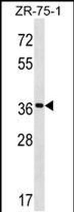 FUT7 Antibody in Western Blot (WB)