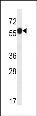 C6orf211 Antibody in Western Blot (WB)