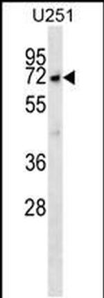 MKKS Antibody in Western Blot (WB)