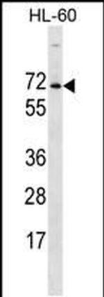ACPL2 Antibody in Western Blot (WB)