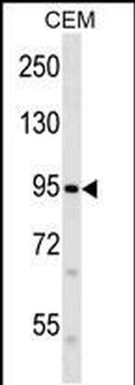 PIEZO2 Antibody in Western Blot (WB)