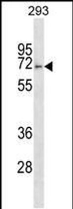 FBXO46 Antibody in Western Blot (WB)