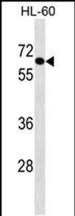AIM1L Antibody in Western Blot (WB)