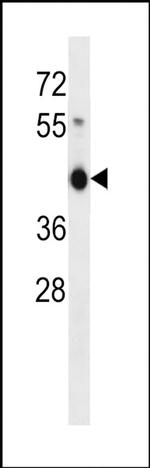 ZNF843 Antibody in Western Blot (WB)