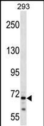 CEP72 Antibody in Western Blot (WB)