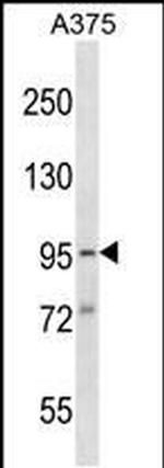 SYDE1 Antibody in Western Blot (WB)