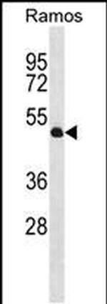 TTL Antibody in Western Blot (WB)
