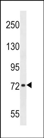 CHADL Antibody in Western Blot (WB)