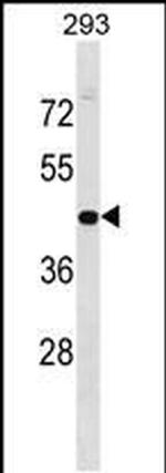 GPN1 Antibody in Western Blot (WB)