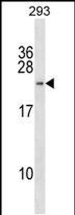 H2BFWT Antibody in Western Blot (WB)