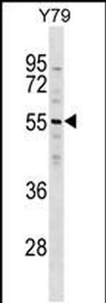 ZNF620 Antibody in Western Blot (WB)