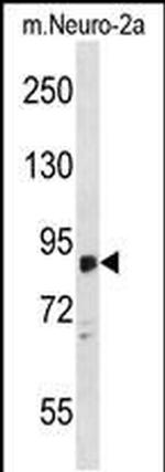 ZDHHC8 Antibody in Western Blot (WB)