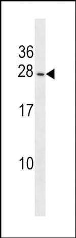 PIGP Antibody in Western Blot (WB)