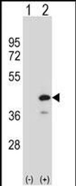 PTPN18 Antibody in Western Blot (WB)
