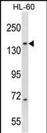 RIMBP3 Antibody in Western Blot (WB)