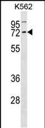 CCNK Antibody in Western Blot (WB)