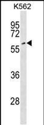 EYA2 Antibody in Western Blot (WB)