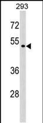 P2X6 Antibody in Western Blot (WB)