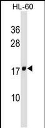 MT-ND4L Antibody in Western Blot (WB)
