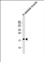 MT-ND4L Antibody in Western Blot (WB)