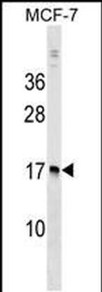 NUDT4 Antibody in Western Blot (WB)