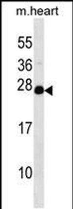 NUDT4 Antibody in Western Blot (WB)