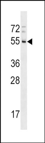 RHD Antibody in Western Blot (WB)