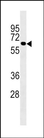 UGT2B10 Antibody in Western Blot (WB)